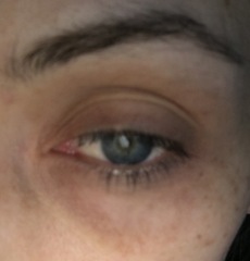 My (eye) bags