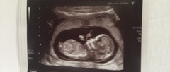 Gender scan tomorrow!