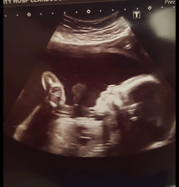 First Time Pregnancy (3)
