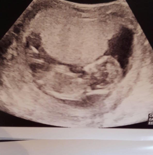 Please guess my scan