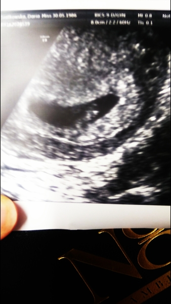 Early scan tomorrow