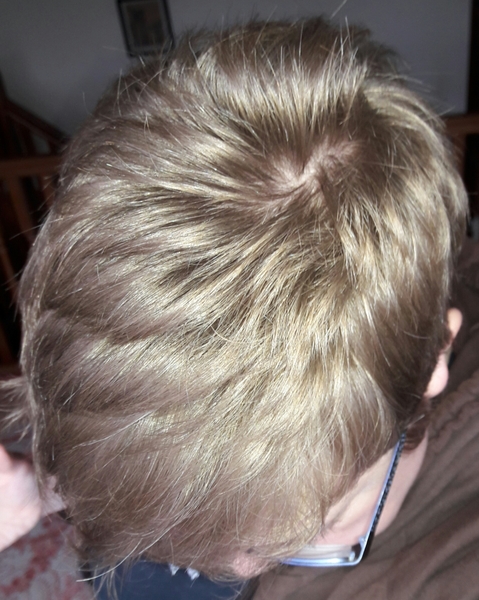 Neurodiversity support thread for women with suspected, diagnosed or self-diagnosed autism, ADHD and other NDs #18