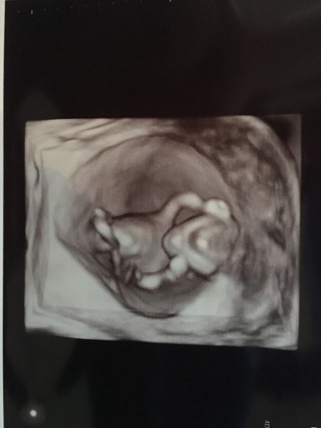 December 2017 babies #5 - dating scans and food chat, and dwindling symptoms???