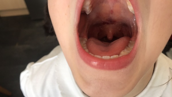What's in dd's mouth? (pic included)