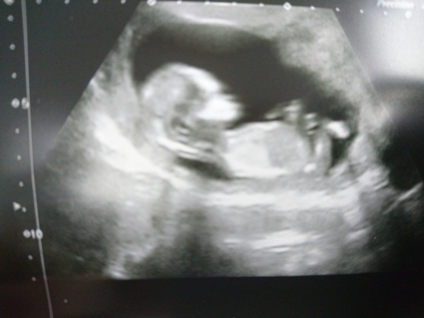 December 2017 babies #6 - dating scans, gender reveals, the beginning of bumps & the 2nd trimester!