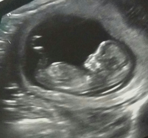 Can we have gender guesses please!