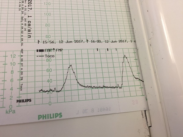 July 2017 #5 - Third Trimester is Here!