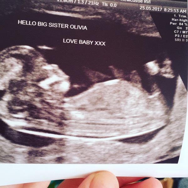 16 weeks girl or boy