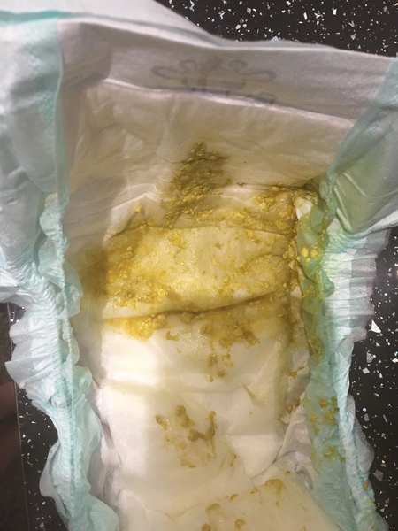 Help, worried about ff baby poo **warning photo included**