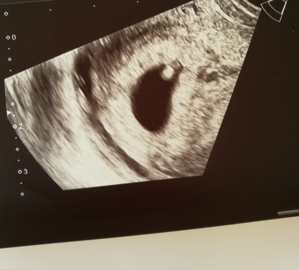 February 2018 Babies!