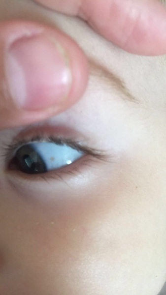Freckle in eye? (Photo)