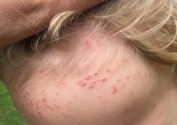 Mystery rash GP stumped