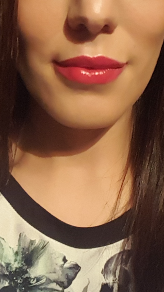to plese ask for your experiences of Botox and lip fillers