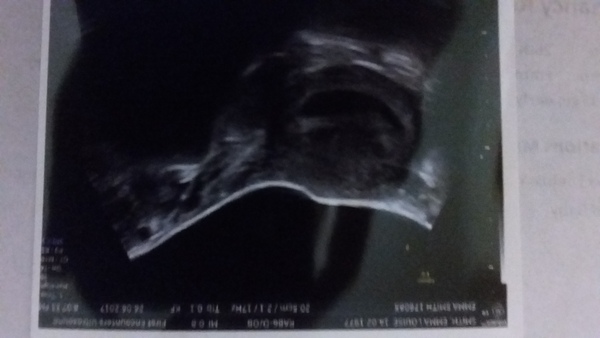 February 2018 Babies!