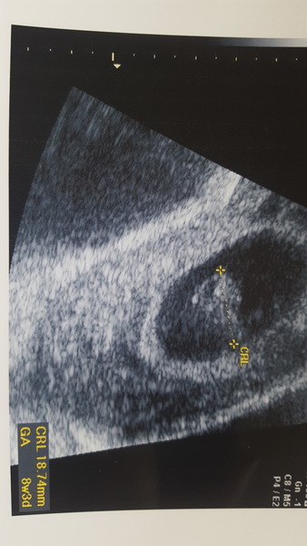 Anyone else just got their BFP?