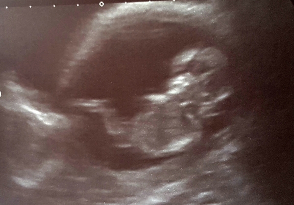 Boy or Girl? Mumsnet Wisdom