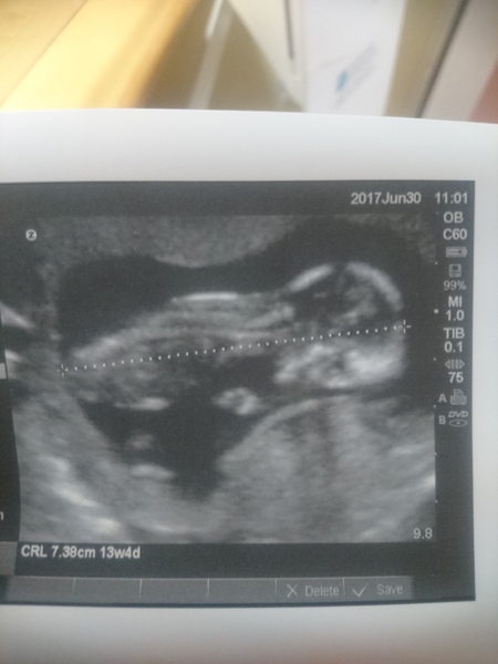 Yet another gender guess......