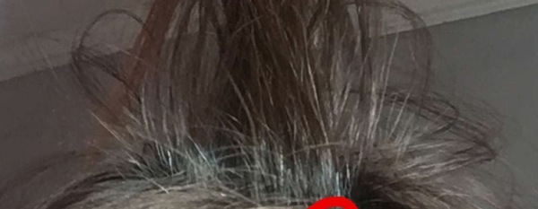 Look at this grey hair at 31!!!