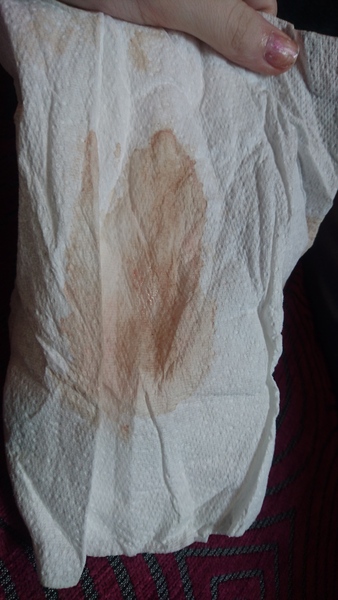 Scared/anxious. Plz help **trigger warning - photograph included. Warning added by MNHQ**