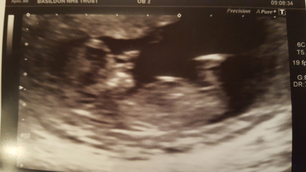 December 2017 babies #6 - dating scans, gender reveals, the beginning of bumps & the 2nd trimester!