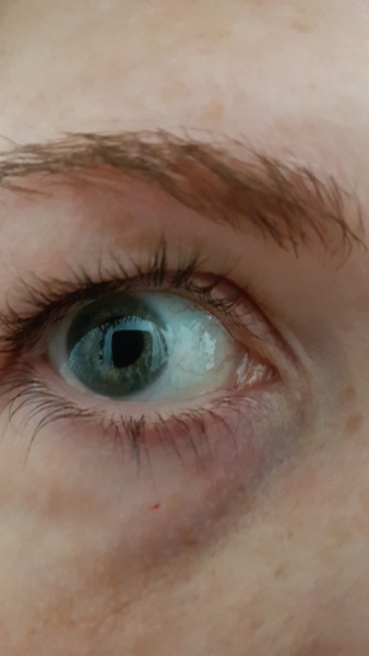 Do you recommend eyelash tinting?
