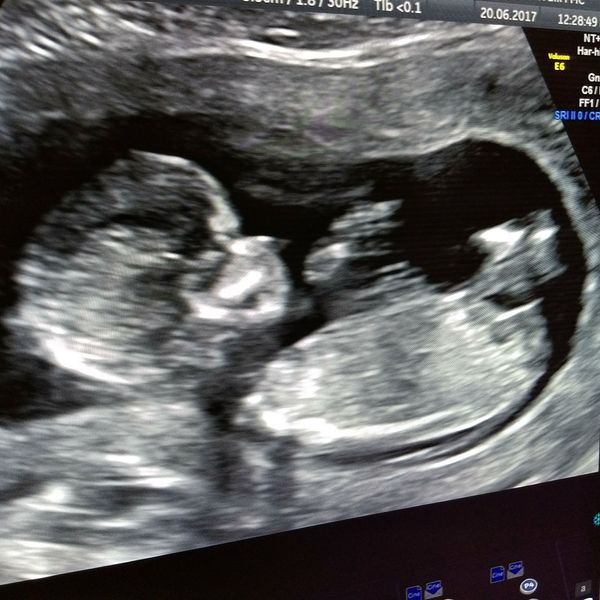 December 2017 babies #6 - dating scans, gender reveals, the beginning of bumps & the 2nd trimester!