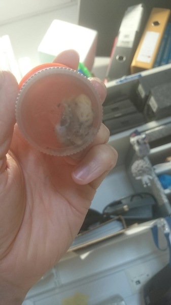 *KLAXON* tonsils came out yesterday