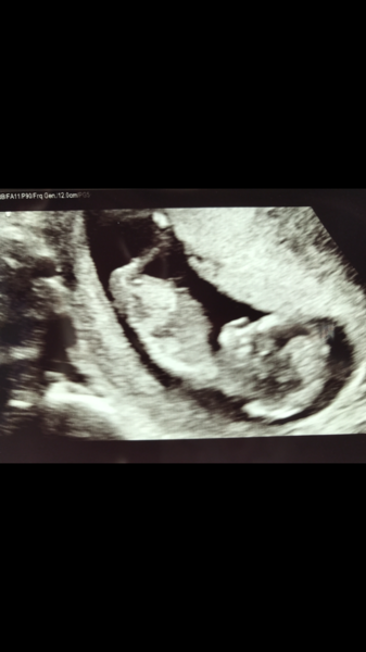 Boy or girl?