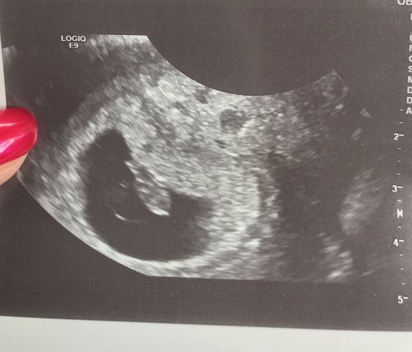 February 2018 Babies!