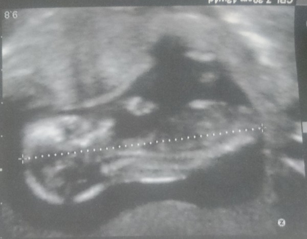 Yet another gender guess......
