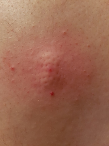 *KLAXON* what the fudge is this on DPs back?