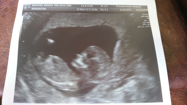 December 2017 babies #6 - dating scans, gender reveals, the beginning of bumps & the 2nd trimester!