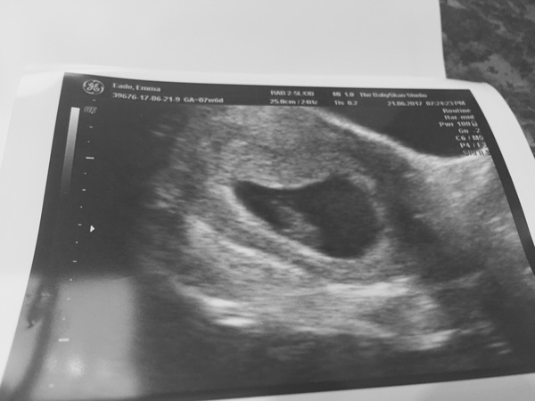 February 2018 Babies!