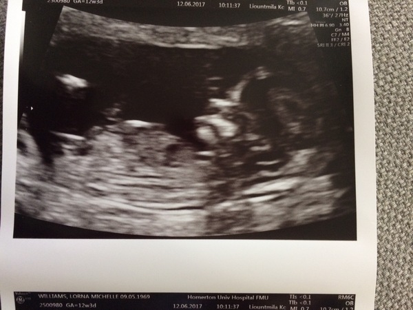 December 2017 babies #6 - dating scans, gender reveals, the beginning of bumps & the 2nd trimester!