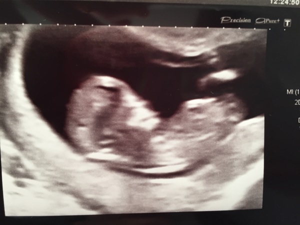 December 2017 babies #6 - dating scans, gender reveals, the beginning of bumps & the 2nd trimester!