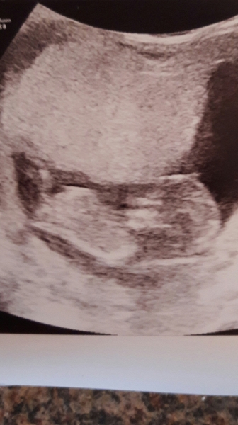 Please guess my scan