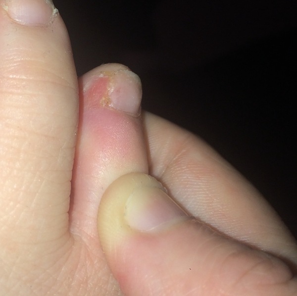 Does this look infected (includes pic)