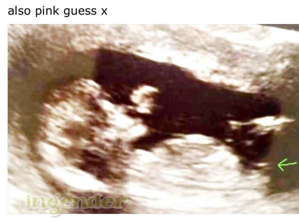 December 2017 babies #6 - dating scans, gender reveals, the beginning of bumps & the 2nd trimester!