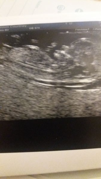 gender guesses please 😘