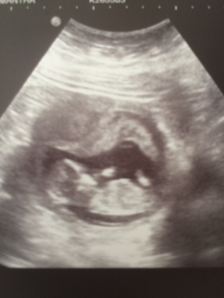 December 2017 babies #6 - dating scans, gender reveals, the beginning of bumps & the 2nd trimester!