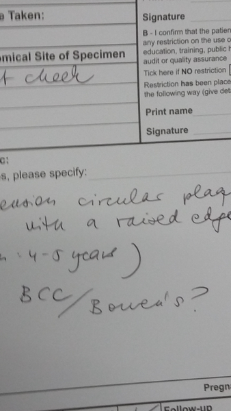 Poss BCC or something else?