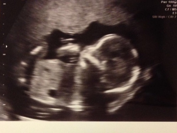 November 2017 #3: Flutters, bubbles and a proper bump!