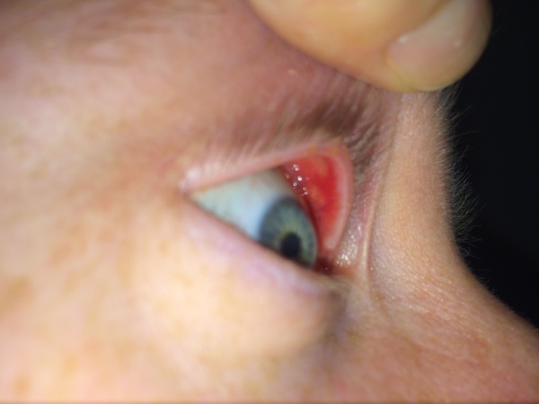 To force DH into going to the optician/GP's- (i.e make an appointment for him like his Mother!!)