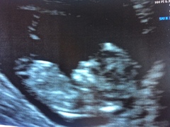 December 2017 babies #5 - dating scans and food chat, and dwindling symptoms???