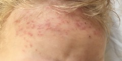 Mystery rash GP stumped