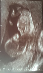 Gender guesses, and nun/skull theorists out there ?