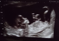 December 2017 babies #6 - dating scans, gender reveals, the beginning of bumps & the 2nd trimester!