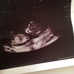 December 2017 babies #6 - dating scans, gender reveals, the beginning of bumps & the 2nd trimester!