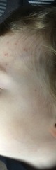 Mystery rash GP stumped