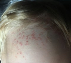 Mystery rash GP stumped
